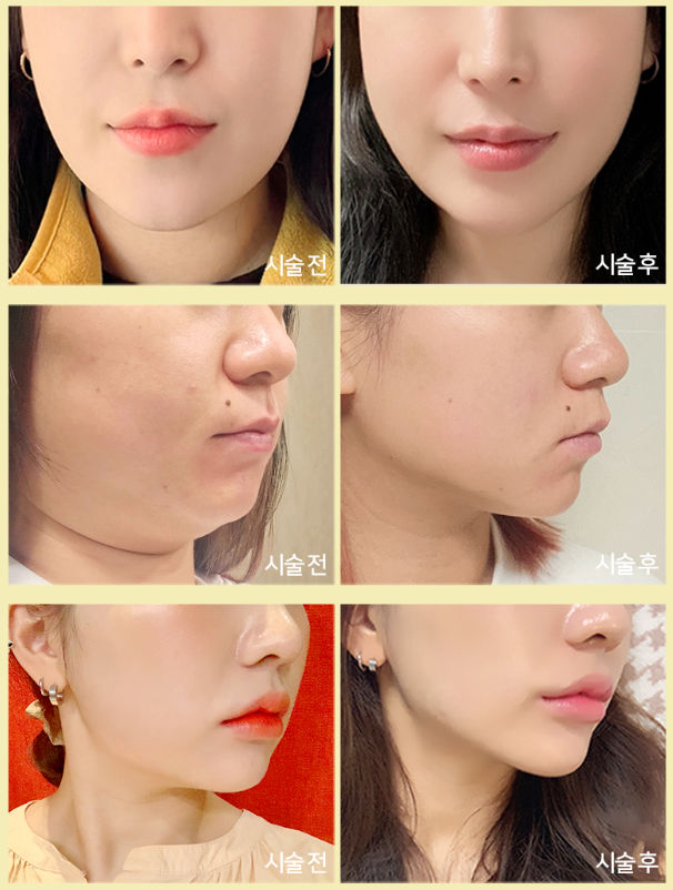 스크린샷 2025-02-11 145054.png