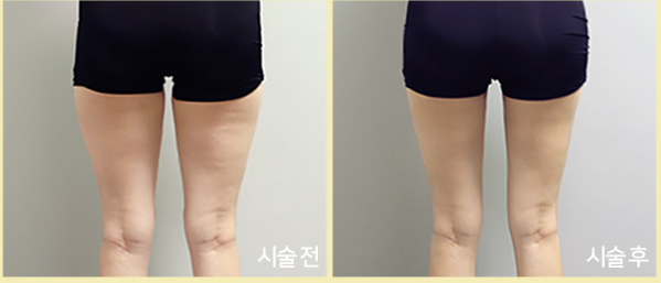 스크린샷 2025-02-11 145128.png