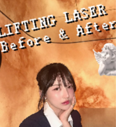 써밋.png